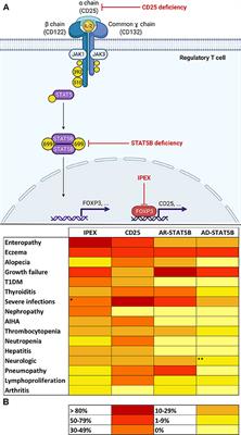 IL-2 Signaling Axis Defects: How Many Faces?